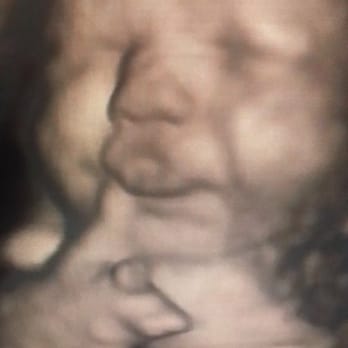 Belly Vision - Blowing raspberries in the womb - Diagnostic Imaging Near Me - Frederick, Maryland