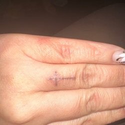 Wonderland Tattoo Studio - Tattoo