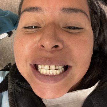 St John Dental - Before the procedure - General Dentistry Near Me - Covina , California St John Dental - Before the procedure - General Dentistry Near Me - Covina , California