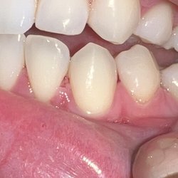 CanAm Dental - My poor gums ):