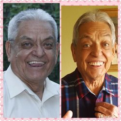 A To Z Dental - Rigoberto Sotelo before and after. Forced him to smile to show the work this place did on him