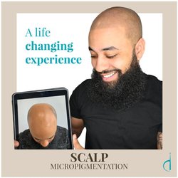 Discreet Cosmetic & Scalp Micropigmentation Studio - Scalp Micropigmentation is the ultimate hair loss solution. 100% guaranteed
