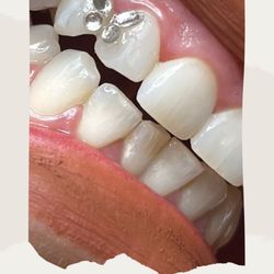 Incredible Beauty Permanent Cosmetics by Corinne Worley - Butterfly teeth gems  
Text/call 831-234-5198