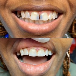 Jacksonville Emergency & Family Dental Care - One visit smile makeover!
