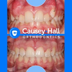 Causey and Hall Orthodontics