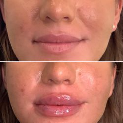 Derma Health Skin & Laser