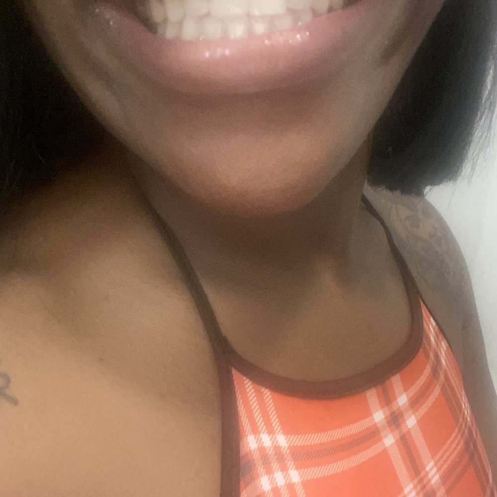 New tooth!!