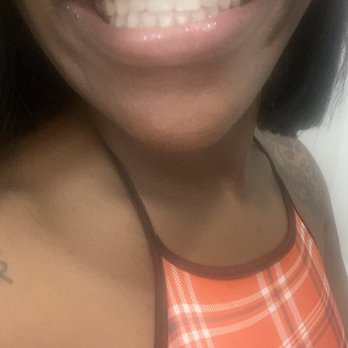 MINT dentistry | Las Colinas - New tooth!! - General Dentistry Near Me - Irving, Texas MINT dentistry | Las Colinas - New tooth!! - General Dentistry Near Me - Irving, Texas