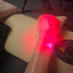 Peak Performance Sports Therapy - MLS Laser reduces inflammation and pain!