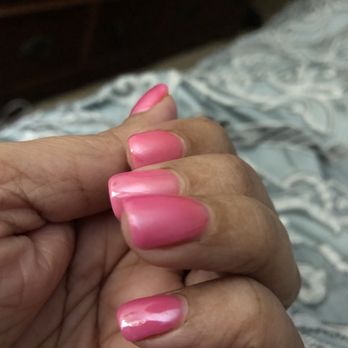 Miracle Nails - Cut cuticle with scab - Nail Salons Near Me - San Antonio, Texas Miracle Nails - Cut cuticle with scab - Nail Salons Near Me - San Antonio, Texas