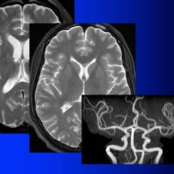 California Advanced Imaging At Atherton - We specialize in musculoskeletal and neuro. MRI imaging