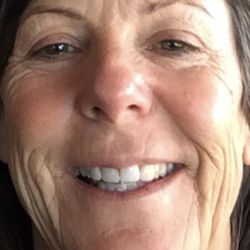 Pablo Prichard, MD - My face before