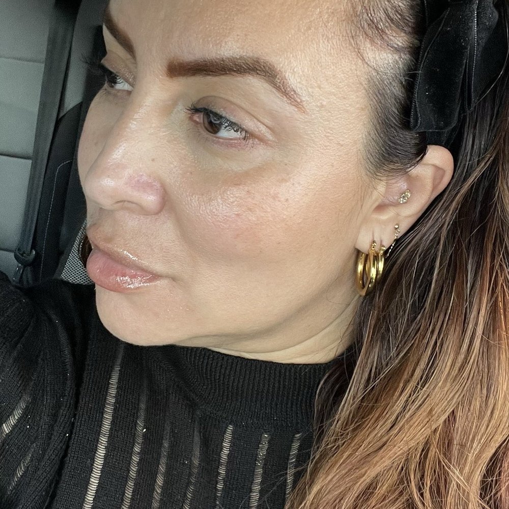 Iconic Skin Clinic- Downey - Lip flip (March 2025) - Medical Spas Near Me - Downey, California Iconic Skin Clinic- Downey - Lip flip (March 2025) - Medical Spas Near Me - Downey, California