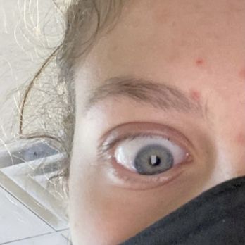 Harper & Olive - right after getting the lash extensions removed at harper & olive salon. In pain, left tiny black ball of god knows what glued onto my lash - Hair Salons Near Me - Nashville, Tennessee