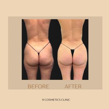 11 Cosmetics Clinic - Medical Spas Near Me - Burbank, California 11 Cosmetics Clinic - Medical Spas Near Me - Burbank, California