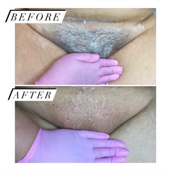 Sugar Smooth - Brazilian wax - Sugaring Near Me - Huntington Beach, California Sugar Smooth - Brazilian wax - Sugaring Near Me - Huntington Beach, California