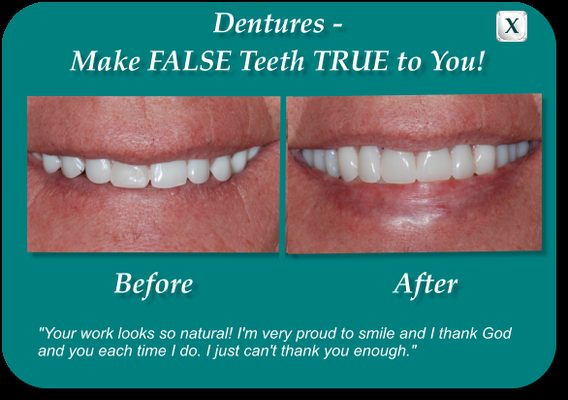Smile Stories - Transforming our patients' smiles is what makes TLC Dental so amazing! We love seeing our patients smile after visiting us.