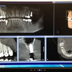 Edgebrook Dental Associates - Our 3D Cone Beam machine with Computer-guided implants