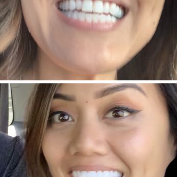 Perfect Smile Dental - Look at this before & after!!! - Cosmetic Dentists Near Me - Tijuana, BCN Perfect Smile Dental - Look at this before & after!!! - Cosmetic Dentists Near Me - Tijuana, BCN