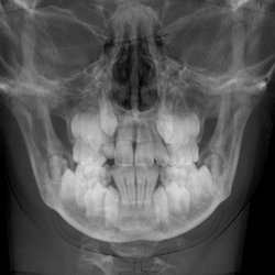 Desert Ridge Implant & Oral Surgery