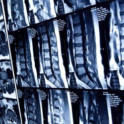 McDonough Paul W MD - Spine MRI