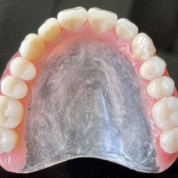 Denture Repair Laboratory  - Upper clear palate