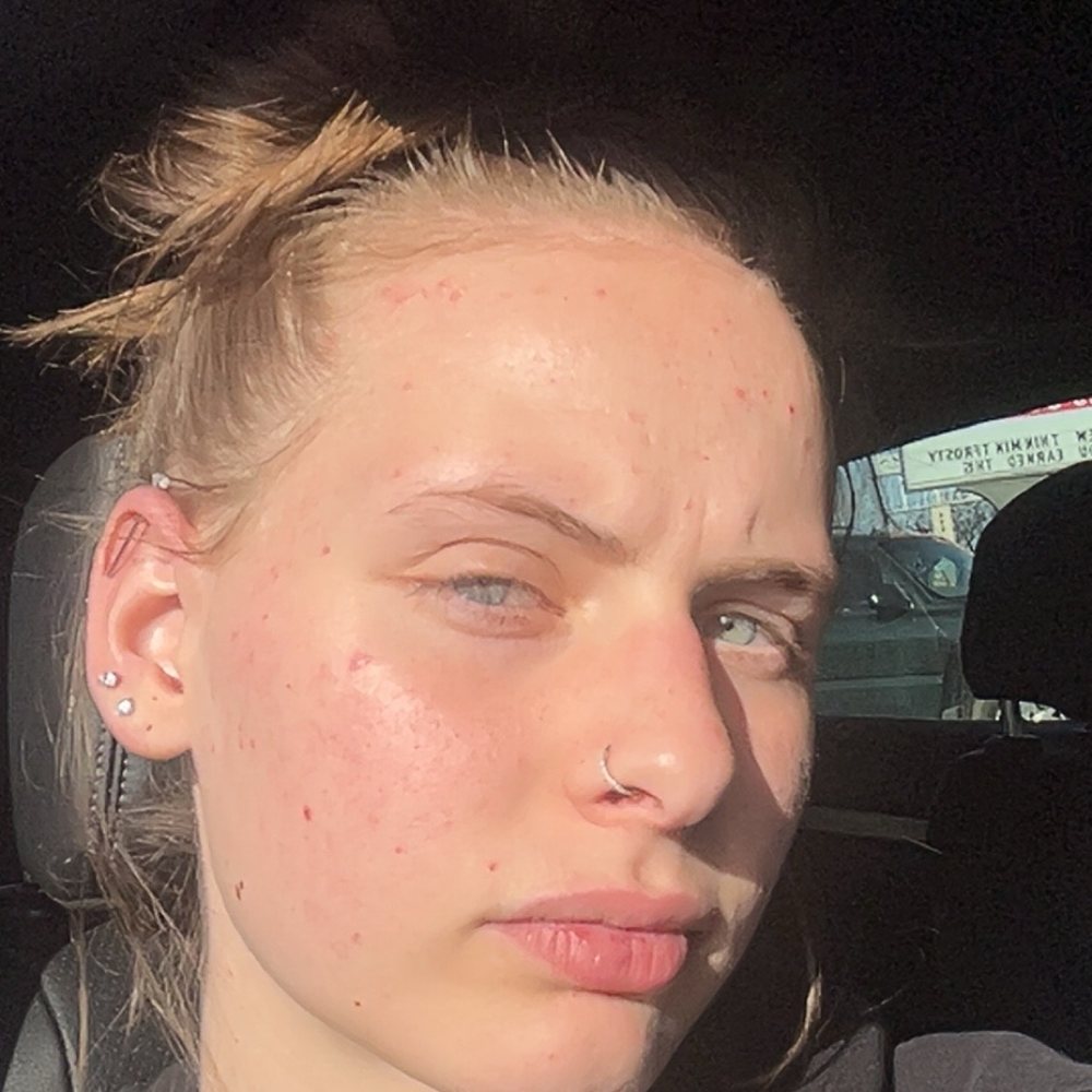 Amazing Lash Studio - More Glow in the Sun - Skin Care Near Me - Denver, Colorado