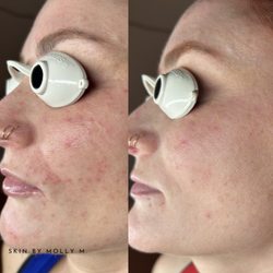 Skin By Molly M