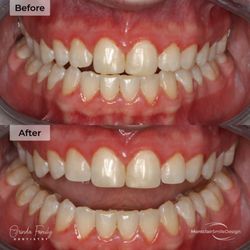 Montclair Smile Design