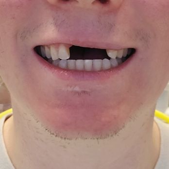 Advanced Dentistry - Prosthodontists Near Me - Portland, Oregon Advanced Dentistry - Prosthodontists Near Me - Portland, Oregon