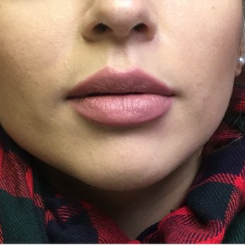 Botox by Dr Landsman - Smithtown - Medical Spas Near Me - Smithtown, New York Botox by Dr Landsman - Smithtown - Medical Spas Near Me - Smithtown, New York