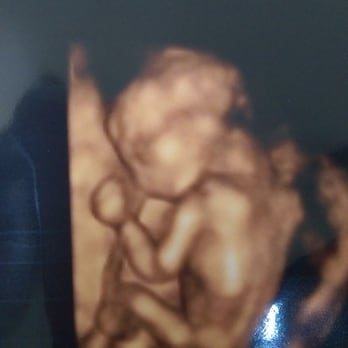 Imaging Miracles - My little girl :) - Diagnostic Imaging Near Me - Springfield, Missouri Imaging Miracles - My little girl :) - Diagnostic Imaging Near Me - Springfield, Missouri