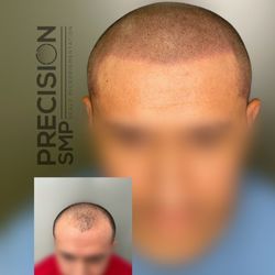 Precision SMP - Nice natural hair line for this client!