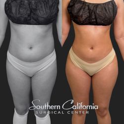 Southern California Surgery Center
