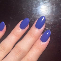 How short the lady cut my nails, plus the blue on my skin that she left How short the lady cut my nails, plus the blue on my skin that she left