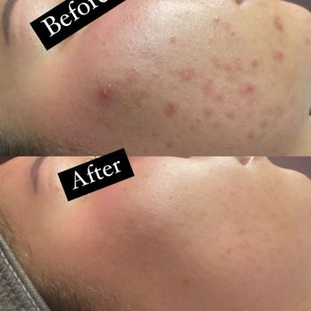 Traes Skin studio - Estheticians Near Me Traes Skin studio - Estheticians Near Me