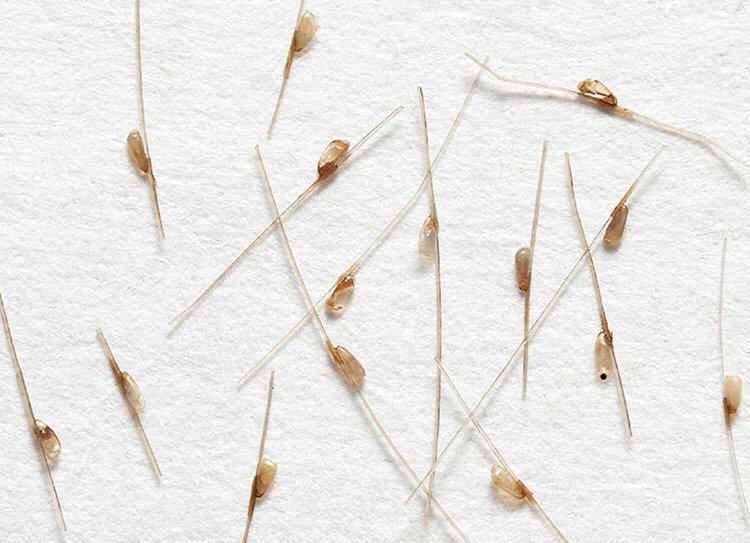 Lice Eggs Attached To Strands Of Hair Yelp