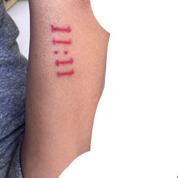 Redink Tattoo Studio - Same tattoo, just in case you couldn't see how bad it was from the other 2. - Tattoo Near Me - New York, New York Redink Tattoo Studio - Same tattoo, just in case you couldn't see how bad it was from the other 2. - Tattoo Near Me - New York, New York