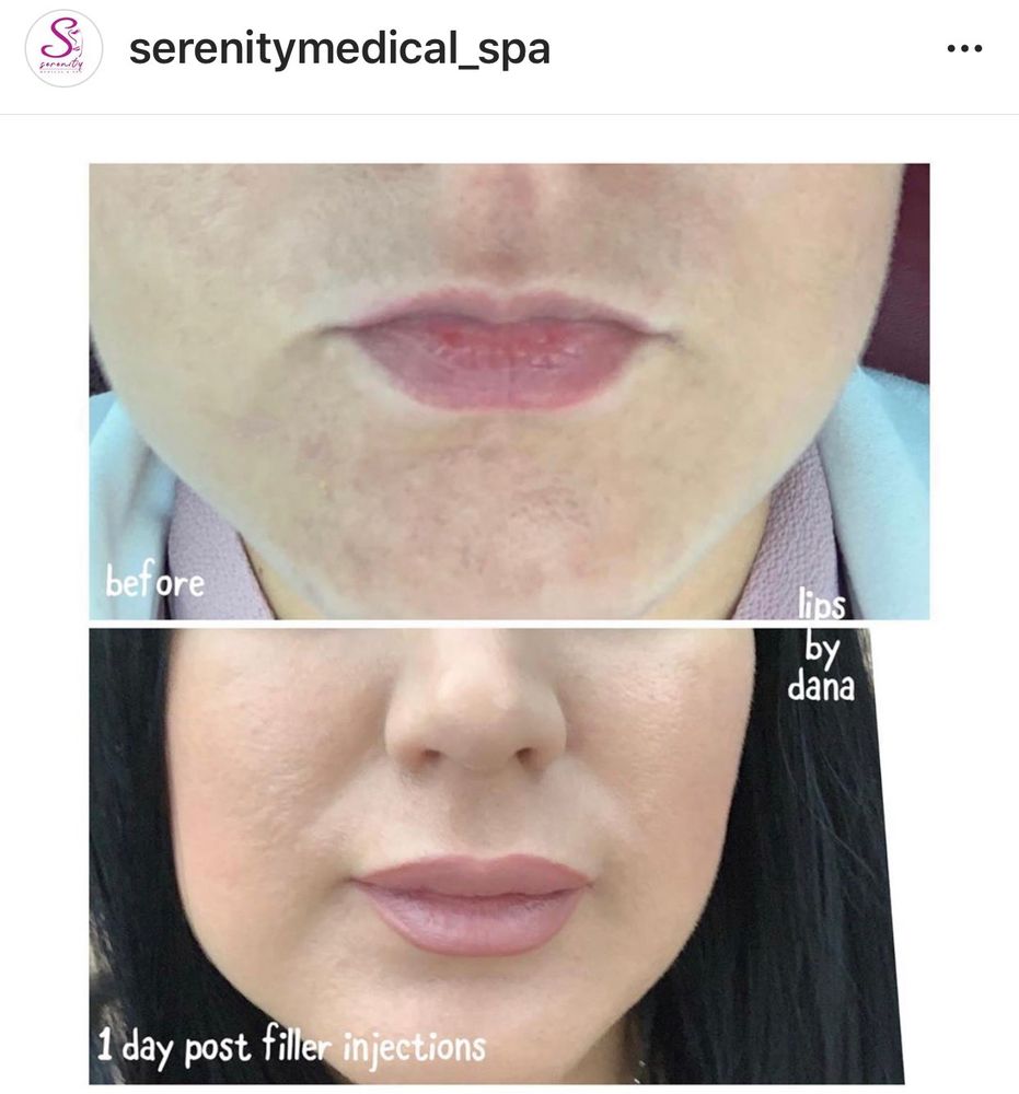 SERENITY MEDICAL SPA 13 Photos 9600 SW 8th St, Miami, Florida