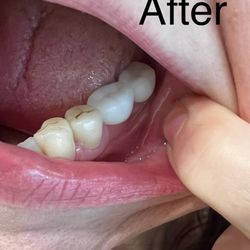 Golden Dental Wellness Center - Not even close in color