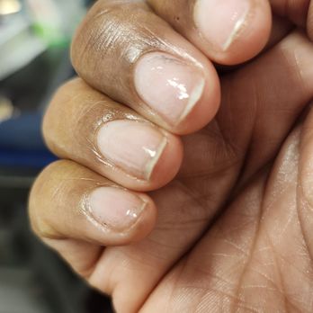 Victorian Nails and Spa - it is hard to see on the picture but my nail bed is damaged still has the digs in it from the drill - Nail Salons Near Me - Pascagoula, Mississippi