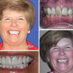 Biltmore Dental Center - Joanne's Smile Gallery
