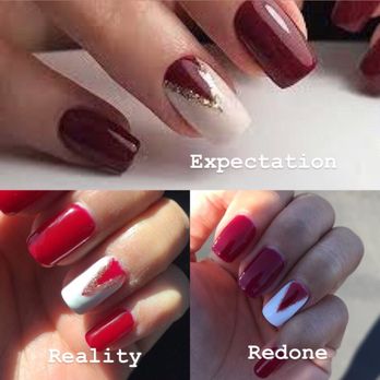 Dazzling Nails Spa - Bottom left was from another nail salon and the right was Hannah's work. I'm so happy with her work. - Nail Salons Near Me - Brentwood, California Dazzling Nails Spa - Bottom left was from another nail salon and the right was Hannah's work. I'm so happy with her work. - Nail Salons Near Me - Brentwood, California