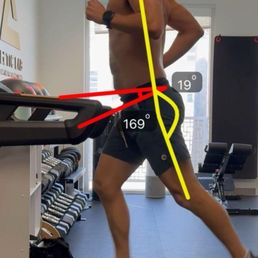 Photo from new provider, not EPT, highlighting anterior pelvic tilt.