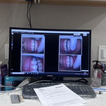 Your Smile Designer - Teeth Whitening! - General Dentistry Near Me - Menifee, California Your Smile Designer - Teeth Whitening! - General Dentistry Near Me - Menifee, California