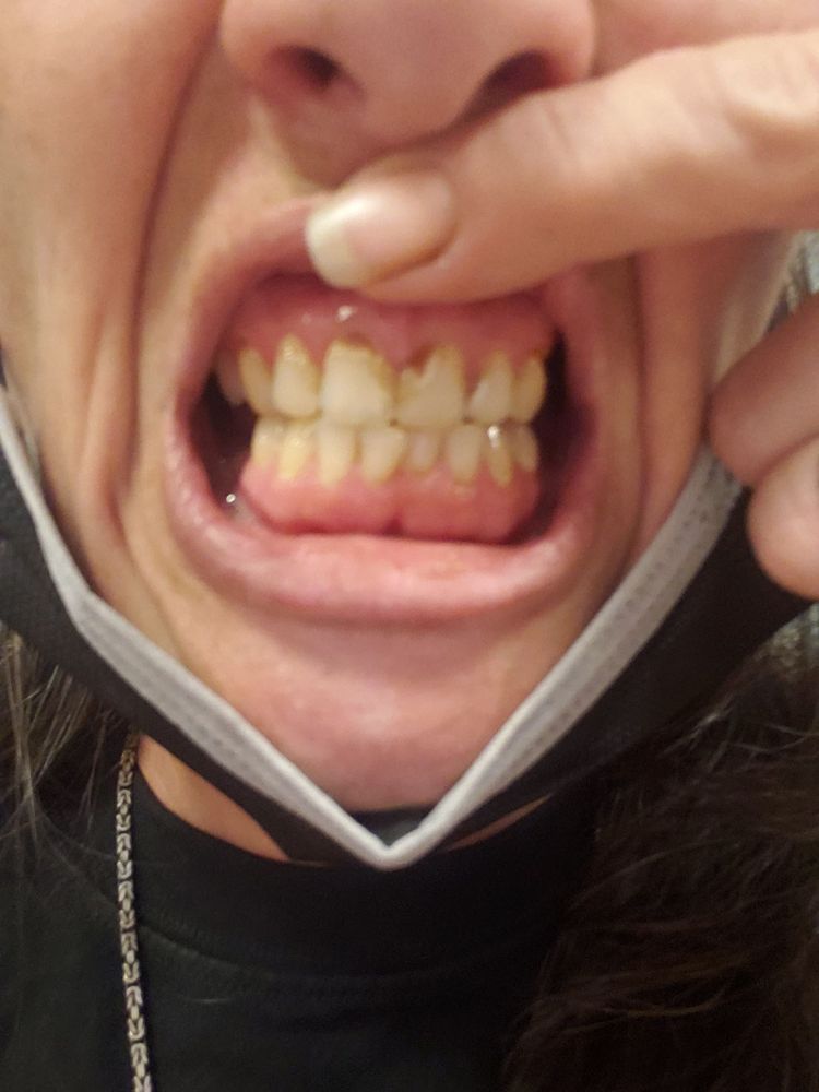 VALLEY DENTAL ASSOCIATES Updated October 2024 13 Photos & 10