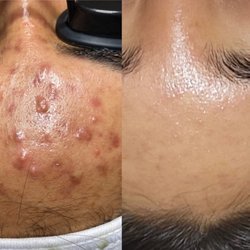 The Beauty Pro - Professional treatments
Serious homecare
TONS of dedication
Patience