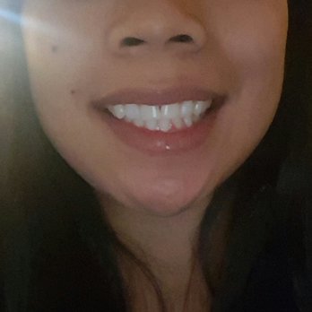 Sterling Pointe Family Dentistry - My perfect smile by Dr. Nawabi! - General Dentistry Near Me - Rocklin, California Sterling Pointe Family Dentistry - My perfect smile by Dr. Nawabi! - General Dentistry Near Me - Rocklin, California