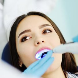 North Road Family Dental - Teeth Whitening