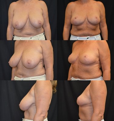 Baroody Plastic Surgery by null